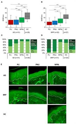 Scratching increases epidermal neuronal branching and alters psychophysical testing responses in atopic dermatitis and brachioradial pruritus